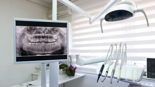 dental digital x ray equipment in dental office
