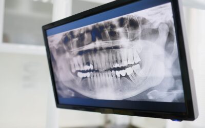 Are Digital X-Rays Safe for Children and Adults?