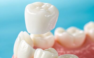 Are Same-Day Crowns as Durable as Traditional Crowns?