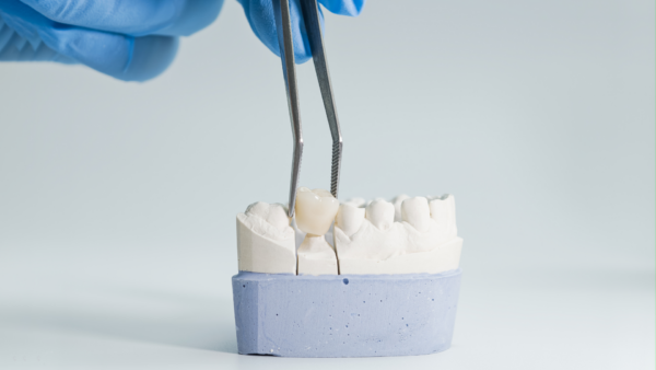 hand holding dental crown with tweezers