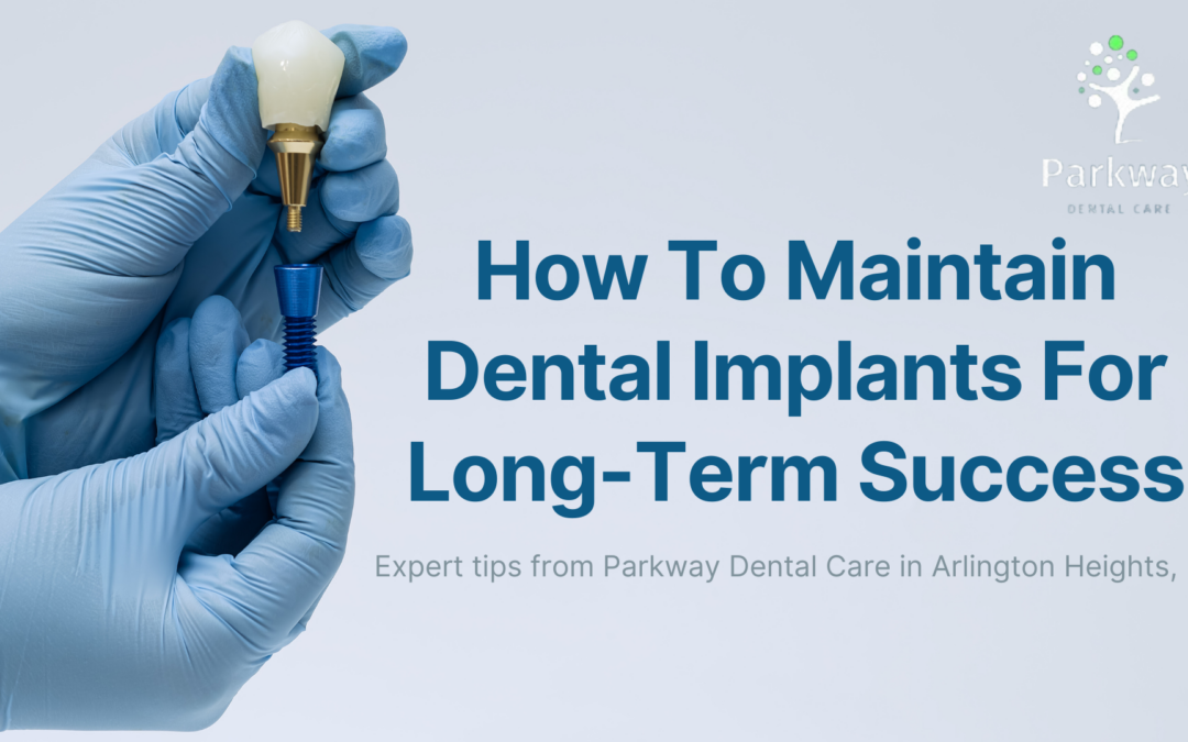 how to maintain dental implants for long term success hero image for blog
