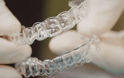 Preparing For Your First Invisalign Appointment In Arlington Heights