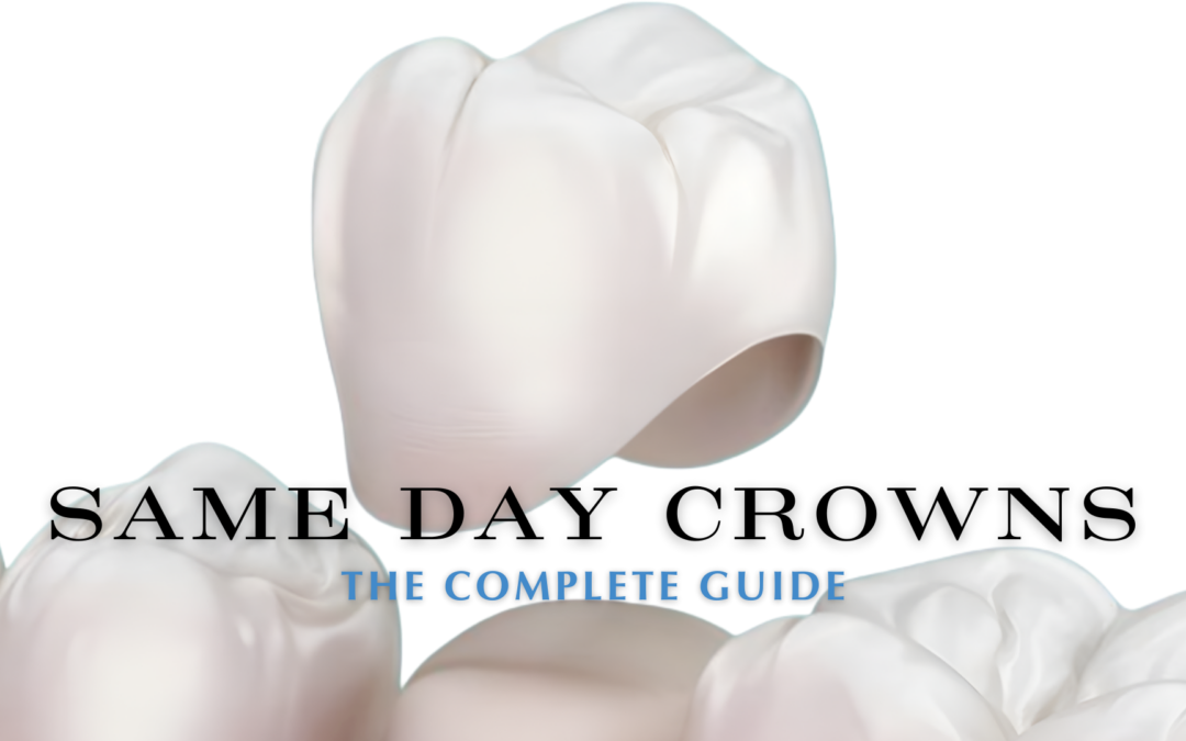 complete guide to same day crowns blog cover of dental crowns