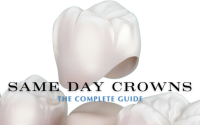The Complete Guide To Same-Day Crowns