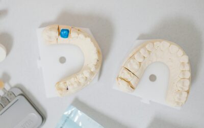 How To Know If You Need A Dental Crown