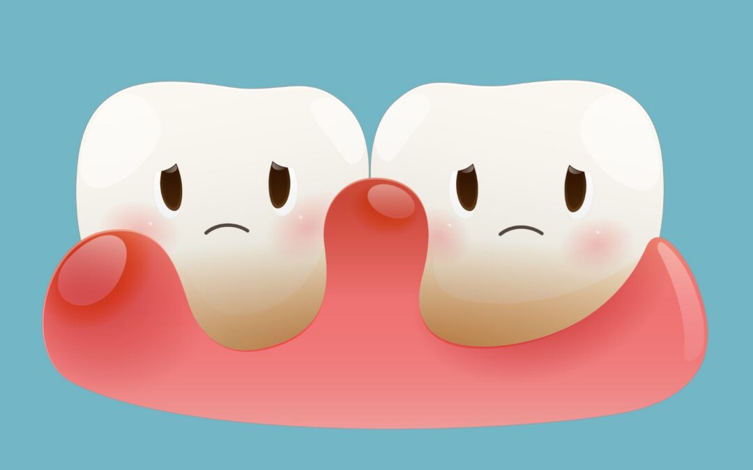 swollen gums